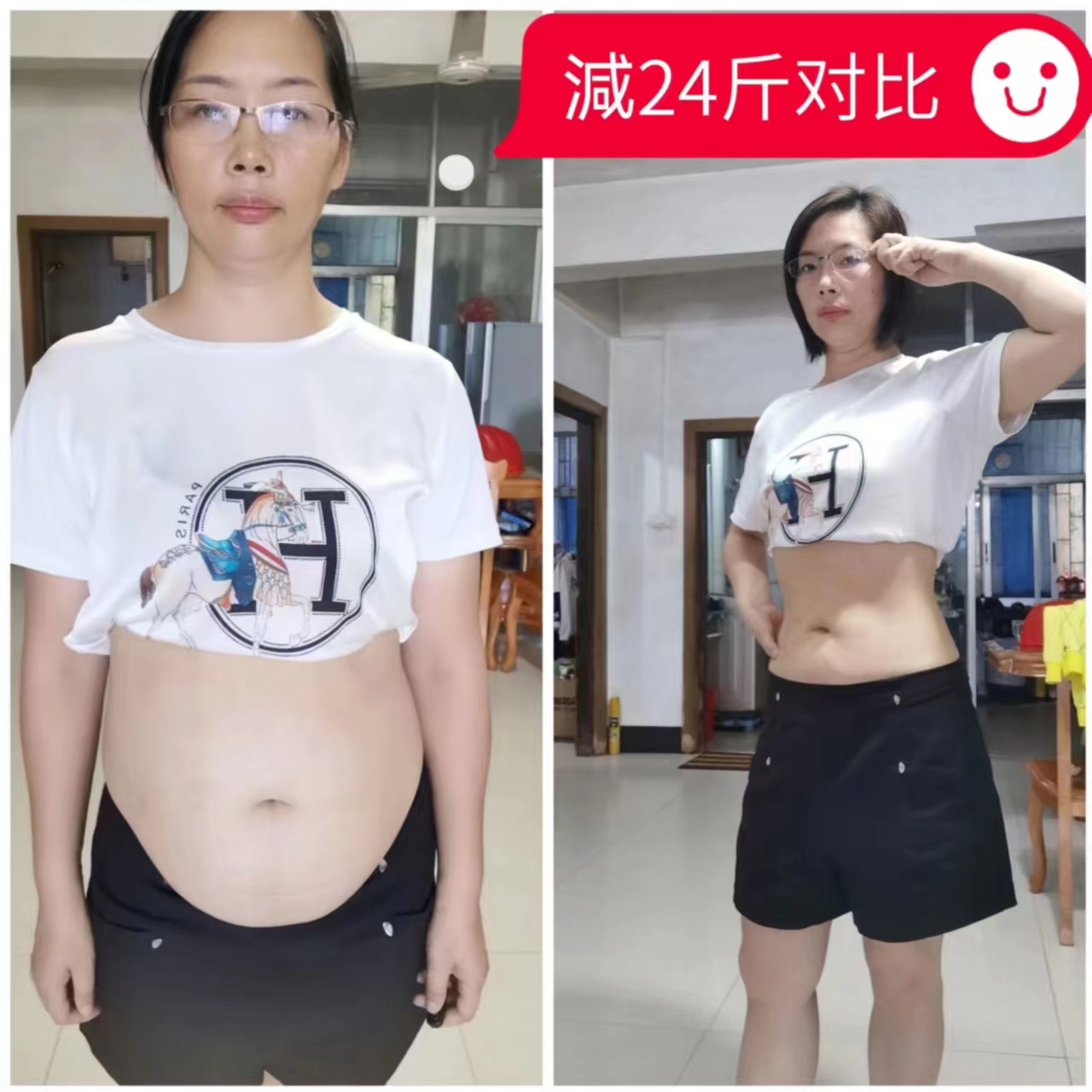  淑女奥秘一个疗程能瘦多少斤